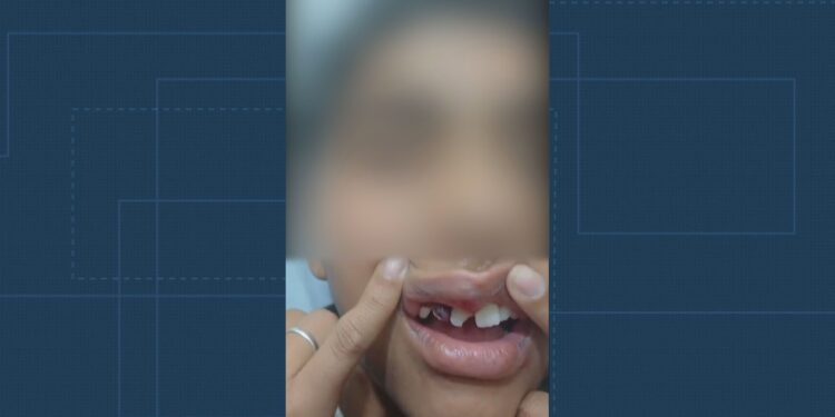 Em 6 meses, dois alunos da rede municipal do Rio foram hospitalizados após casos de bullying